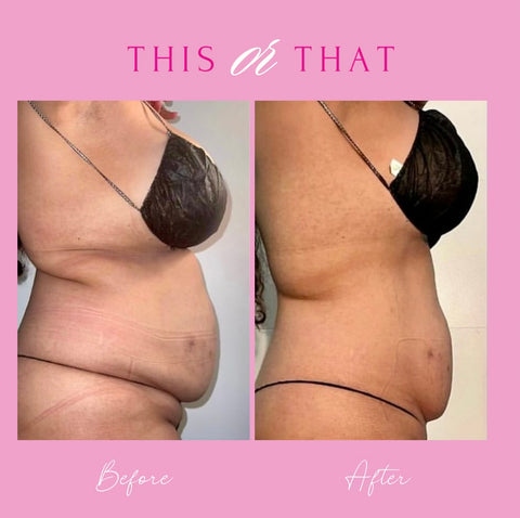 Snatched Waist Sculpting Package (6 treatments)