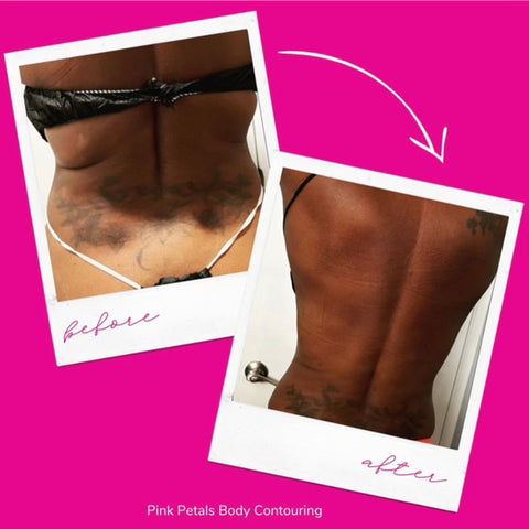 Snatched Waist Sculpting Package (6 treatments)